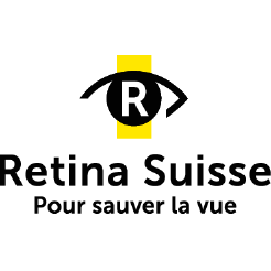 retina