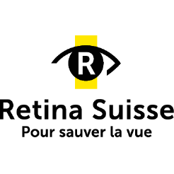 retina